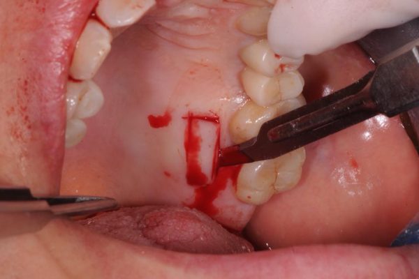 parodontologia