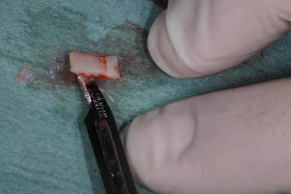 parodontologia