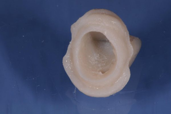 protesi-fissa-e-mobile